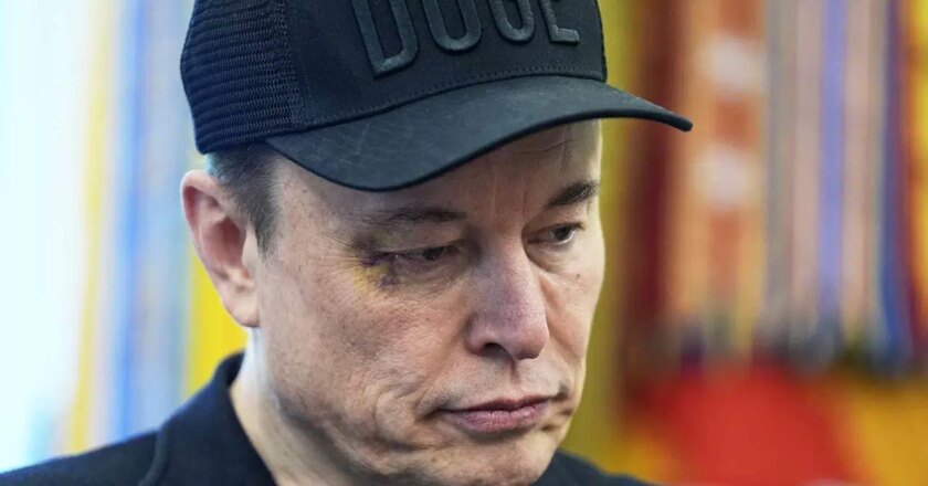 Gözlerindeki çürük dikkat çekti: Elon Musk nedenini açıkladı: Dünya Haberlerini Breaking