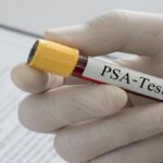 PSA testi nedir, ne yapar? Yüksekliği ve yüksekliği ne anlama geliyor?